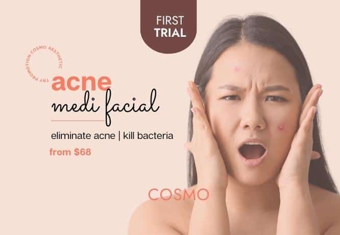 acne facial trial