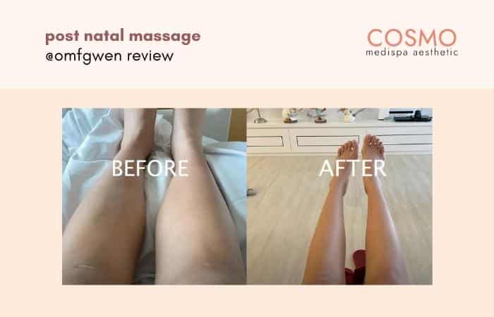 post natal massage before and after