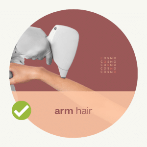 arm laser hair removal