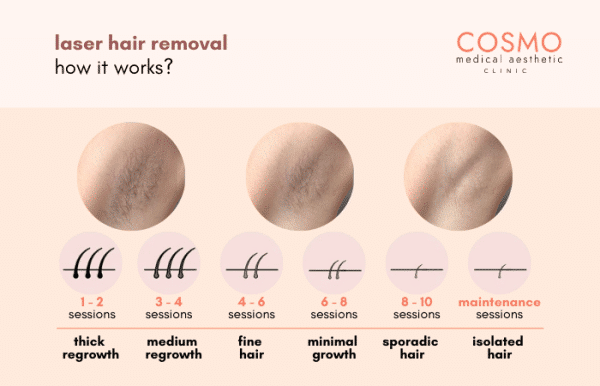 Laser Hair Removal: Benefits, Reviews & Price (2025)