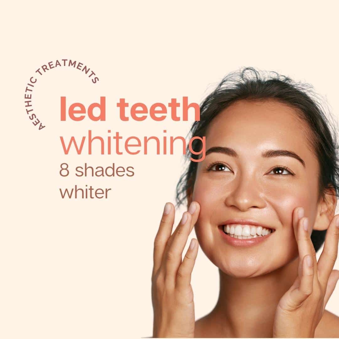 Teeth Whitening Price & Review (2023) Cosmo Aesthetic