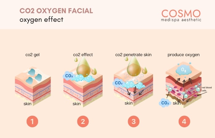 how does co2 oxygen facial work?