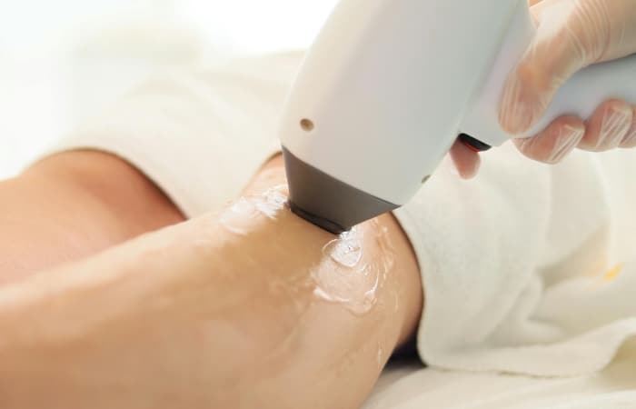 What to Expect During a Laser Hair Removal Treatment